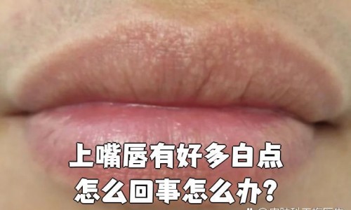 打狂犬疫苗期间可以跑步吗-狂犬疫苗期间能运动吗网- 打了狂犬疫苗可以健身运动吗知识,分享打了狂犬疫苗可以健身运动吗
